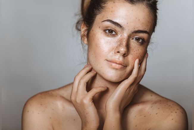 Voici De Quoi Se Faire Des Fausses Taches De Rousseur Naturellement