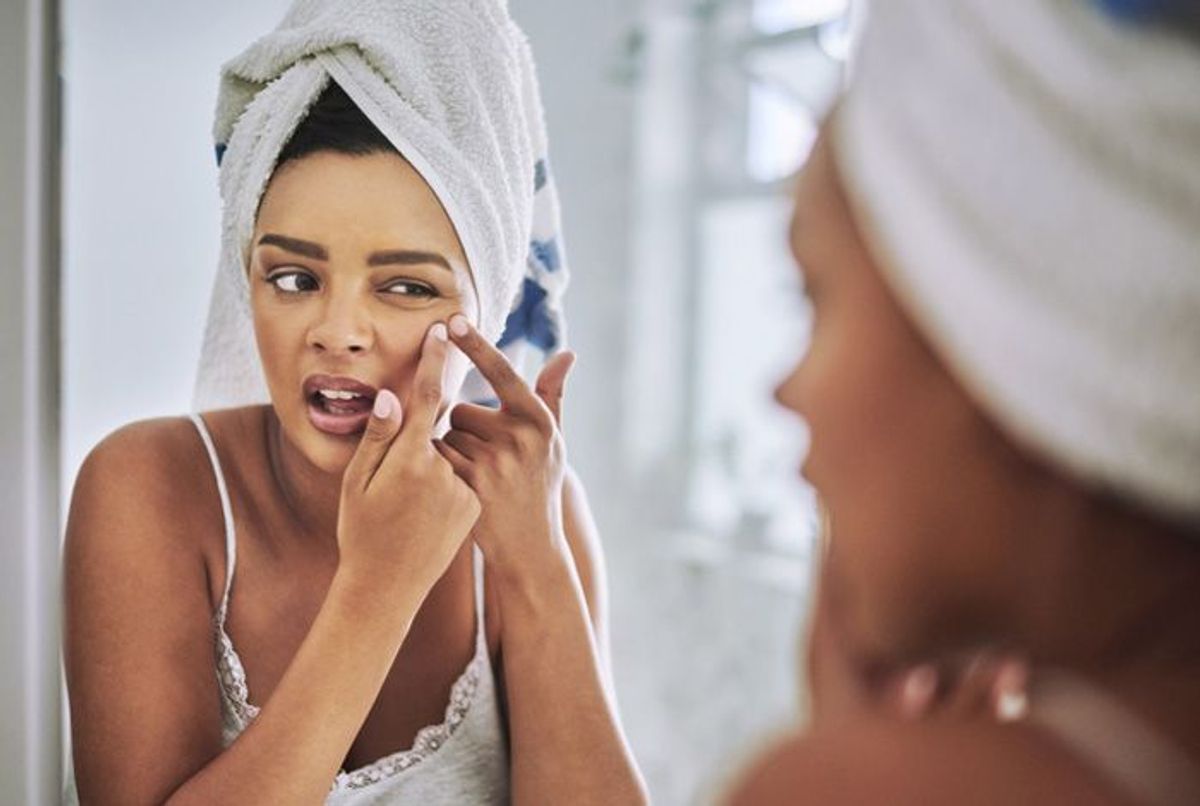 Acné : comment ne plus avoir de boutons