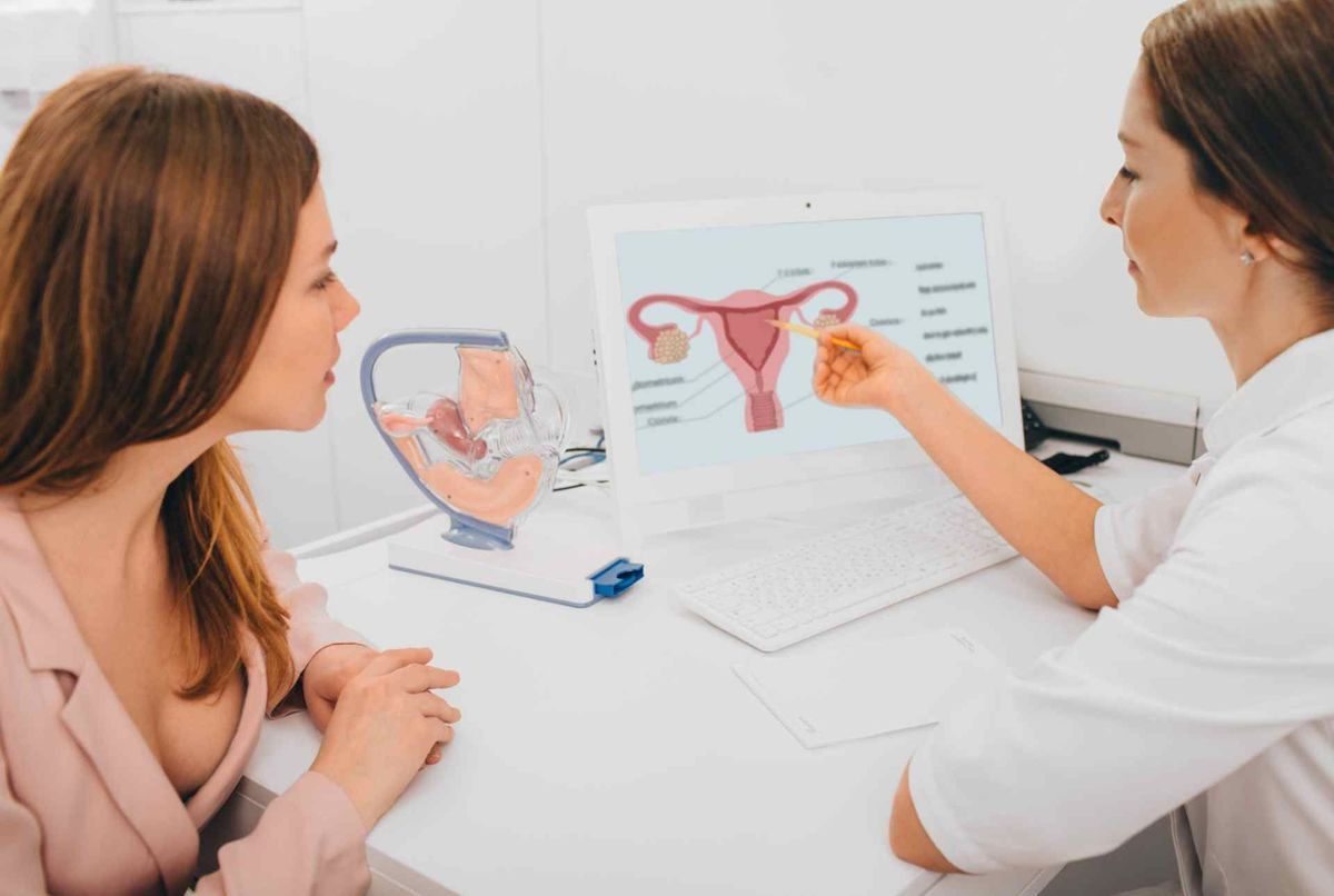 Microbiote intestinal et syndrome des ovaires polykystiques : existe-t-il un lien ?