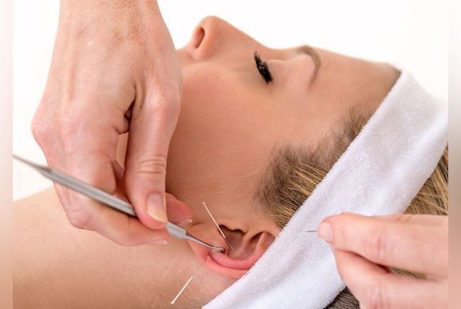 Auriculothérapie : cette pratique qui soigne les maux par l'oreille