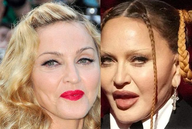 Madonna : son visage déformé choque les fans qui ne la reconnaissent pas aux Grammy Awards
