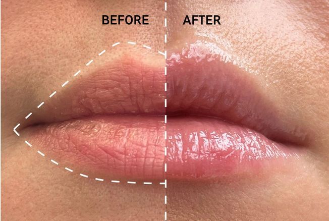 lip balm c'est quoi Ce baume à lèvres repulpant est vendu toutes les 35 secondes dans le monde each delivering nourishing benefits. Lip Balm - Baume pour